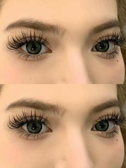 Will eyelashes grow back if they fall off(pic1)