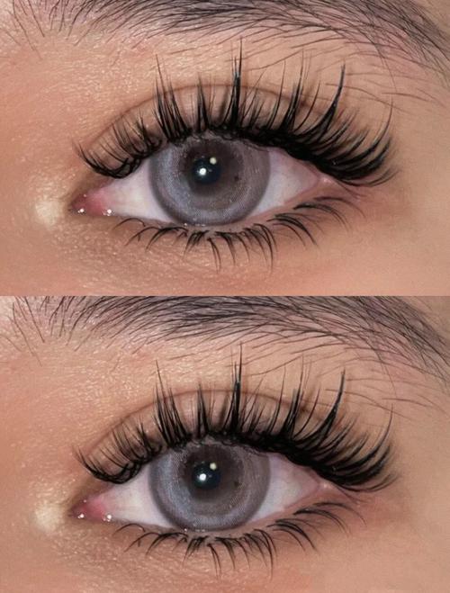 Why do eyelashes always fall off(pic1)